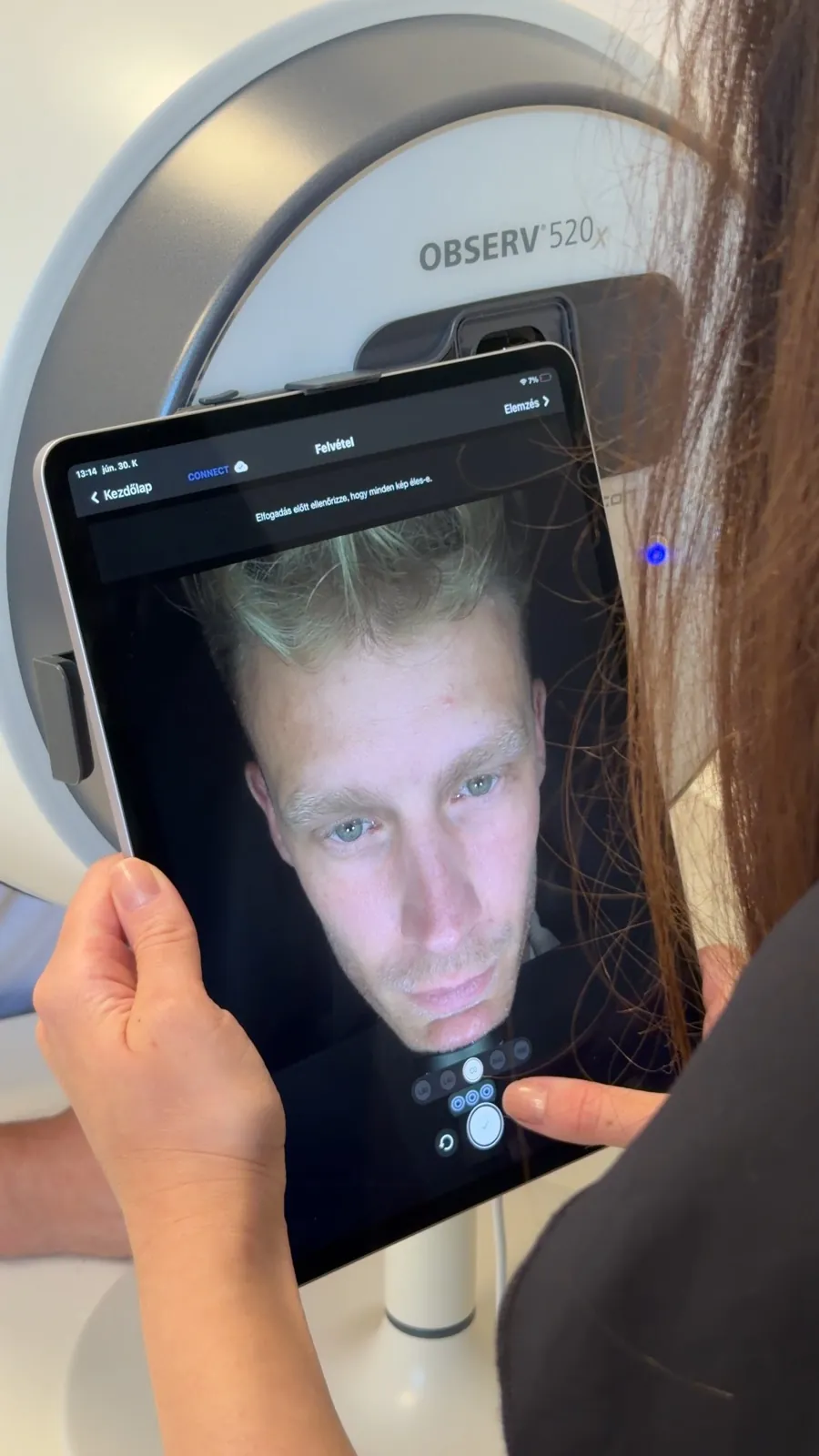 Observ 520x bőrdiagnosztika működés közben
