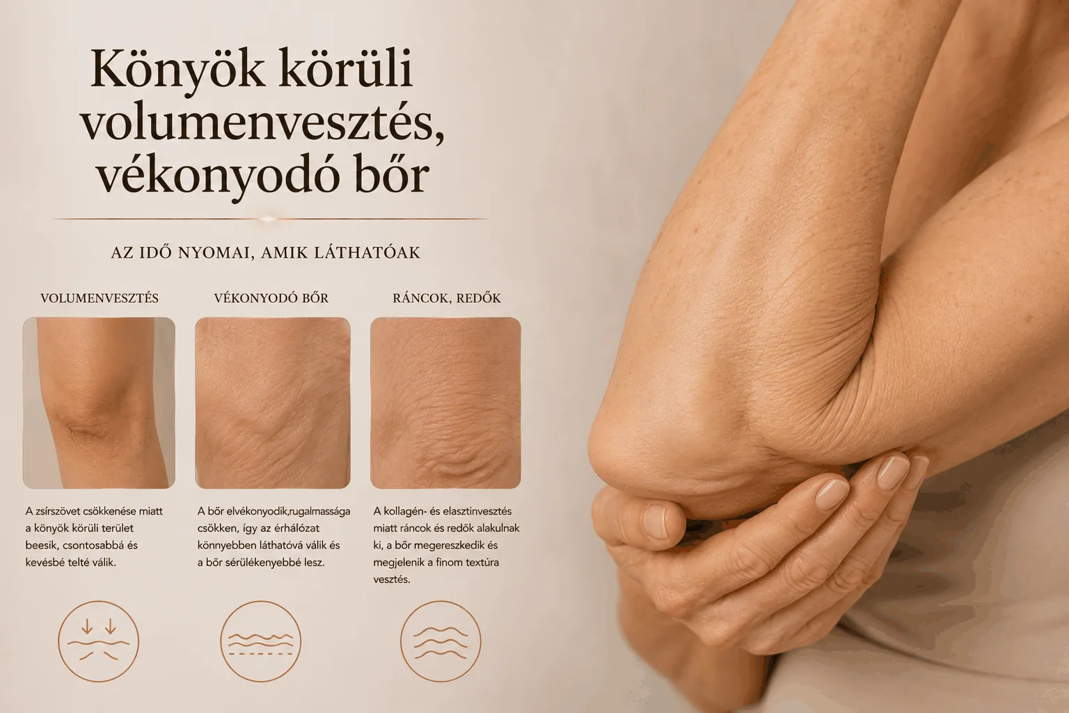 Könyök körüli volumenvesztés, vékonyodó bőr — volumenvesztés, vékonyodó bőr, ráncok és redők