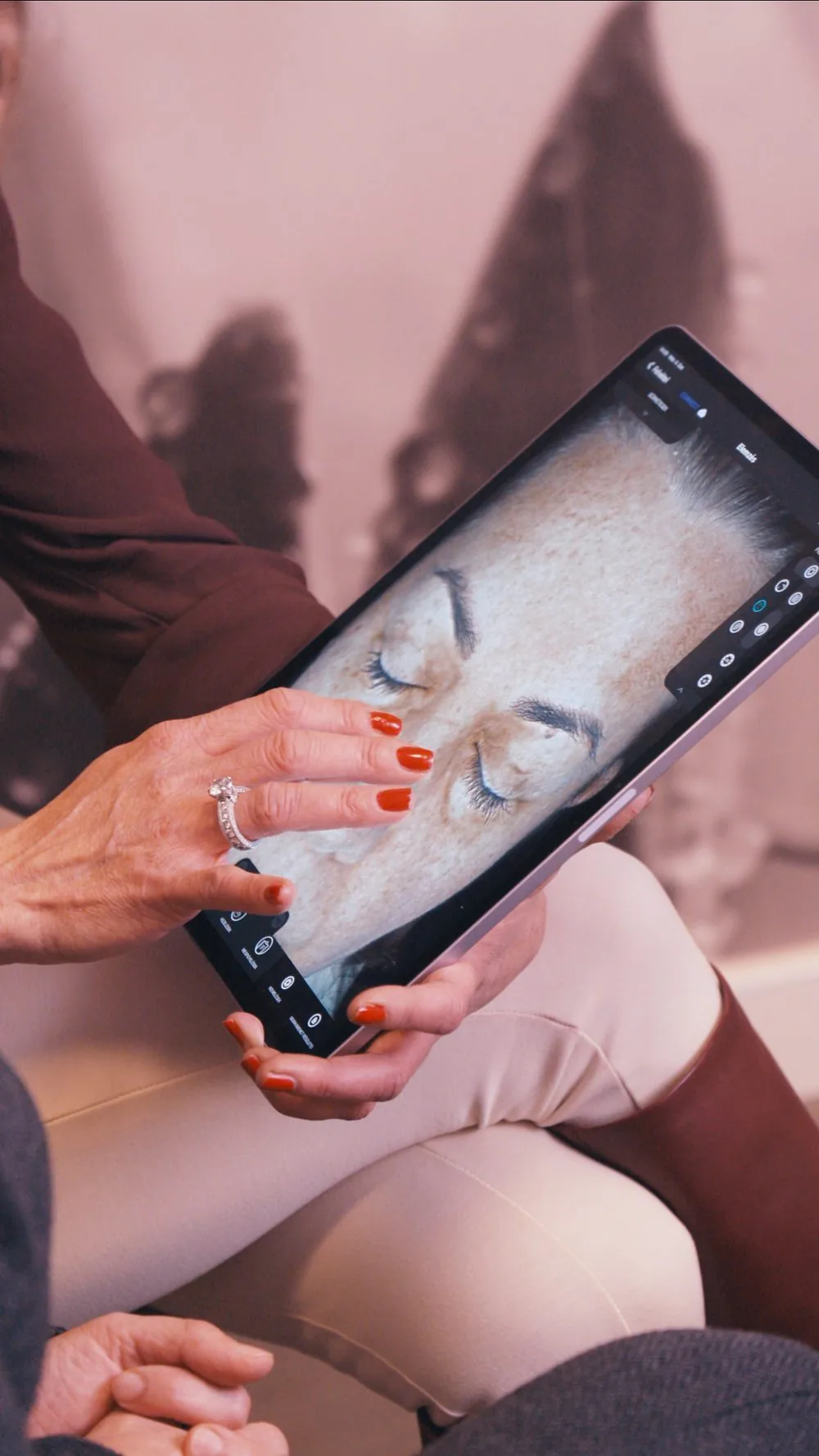 Observ 520x bőrdiagnosztikai felvétel egy konzultáción