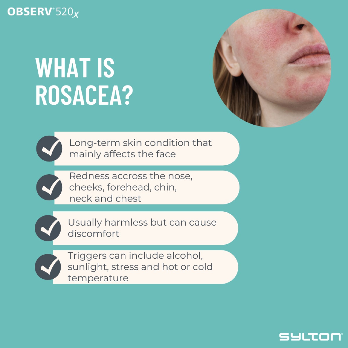 5/14 — Rosacea