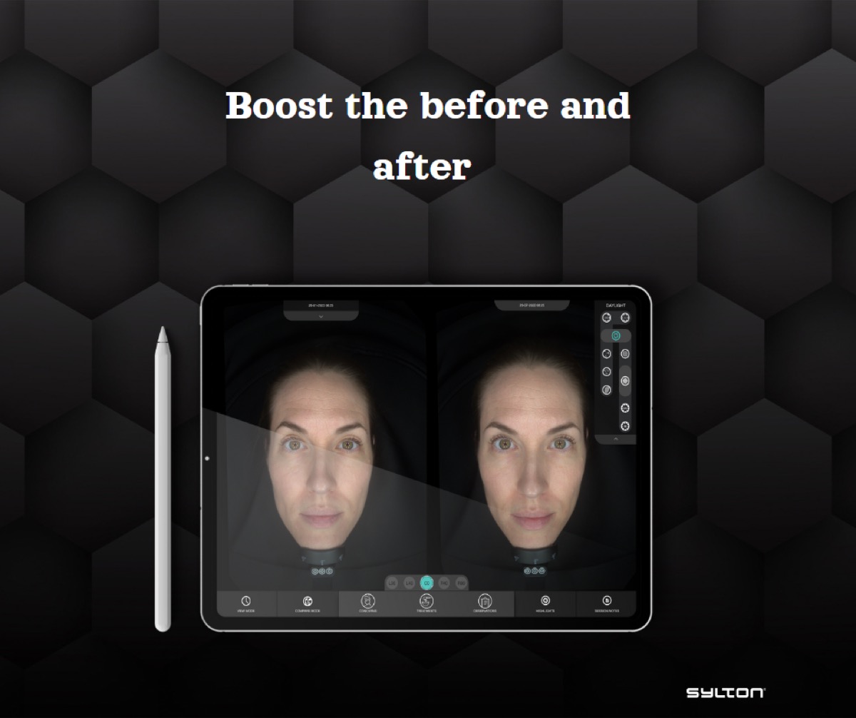 10/14 — Pigmentáció elemzés