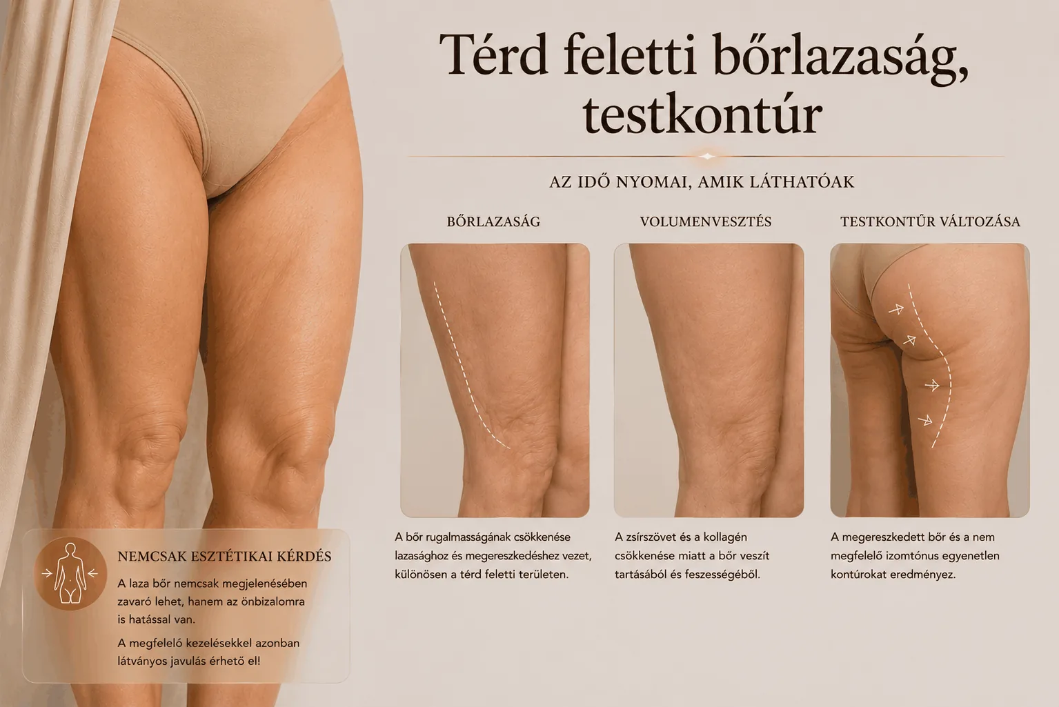Térd feletti bőrlazaság, testkontúr — bőrlazaság, volumenvesztés, testkontúr változása